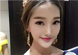 ����ʧ��23����ģ����(������425)