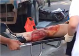 ������ᮺ��̵����س���(������598)